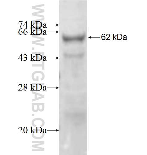 ST3GAL5 fusion protein Ag6207 SDS-PAGE