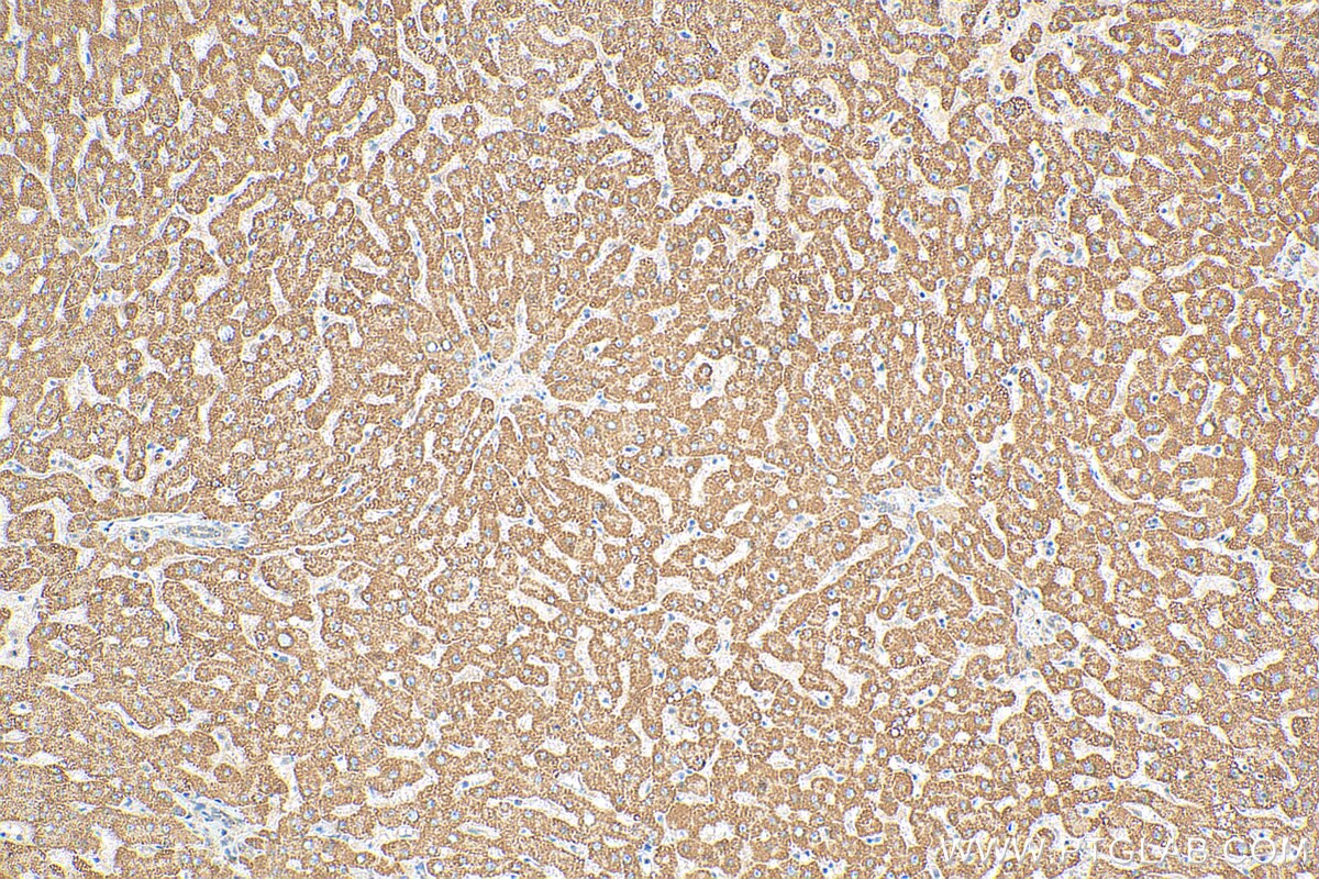 Immunohistochemistry (IHC) staining of human liver tissue using ST3GAL6 Polyclonal antibody (13154-1-AP)