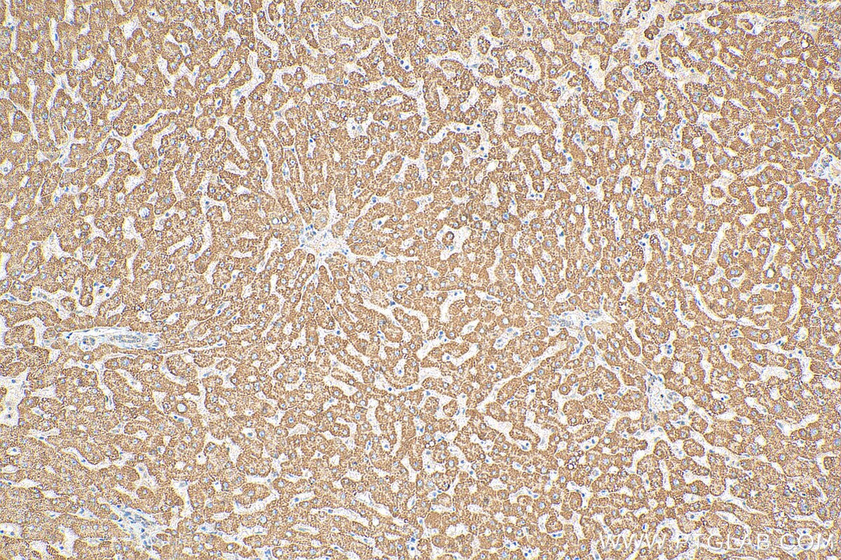 IHC staining of human liver using 13154-1-AP