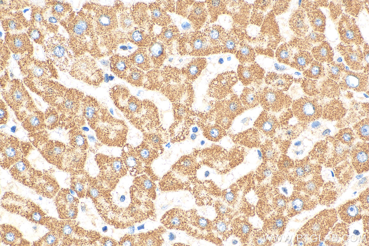 Immunohistochemistry (IHC) staining of human liver tissue using ST3GAL6 Polyclonal antibody (13154-1-AP)