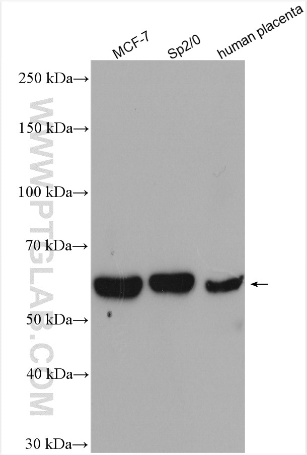 Western Blot (WB) analysis of various lysates using ST3GAL6 Polyclonal antibody (13154-1-AP)