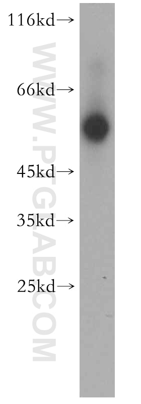 Western Blot (WB) analysis of human heart tissue using ST3GAL6 Polyclonal antibody (13154-1-AP)