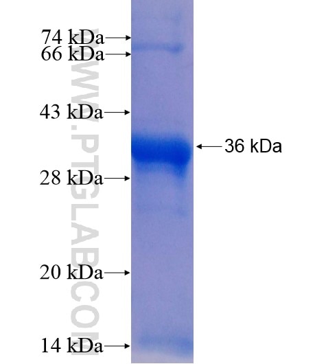 ST3GAL6 fusion protein Ag14399 SDS-PAGE