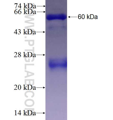 ST3GAL6 fusion protein Ag3782 SDS-PAGE