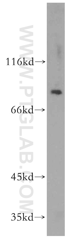 Western Blot (WB) analysis of human testis tissue using ST5 Polyclonal antibody (12893-1-AP)