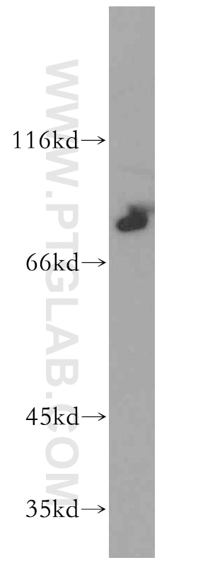 Western Blot (WB) analysis of SH-SY5Y cells using ST5 Polyclonal antibody (12893-1-AP)