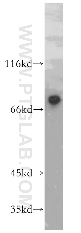Western Blot (WB) analysis of HeLa cells using ST5 Polyclonal antibody (12893-1-AP)