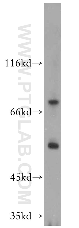 Western Blot (WB) analysis of mouse uterus tissue using ST5 Polyclonal antibody (12893-1-AP)