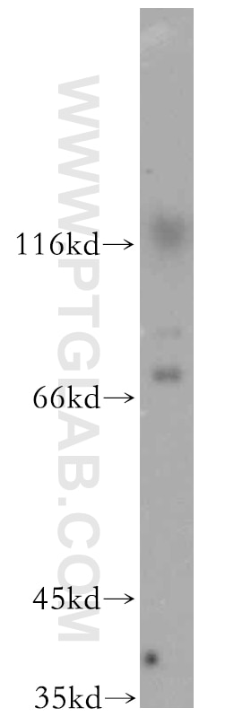 Western Blot (WB) analysis of human adrenal gland tissue using ST5 Polyclonal antibody (12893-1-AP)