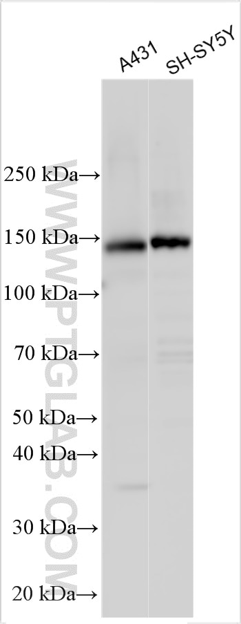 Western Blot (WB) analysis of various lysates using ST5 Polyclonal antibody (30996-1-AP)