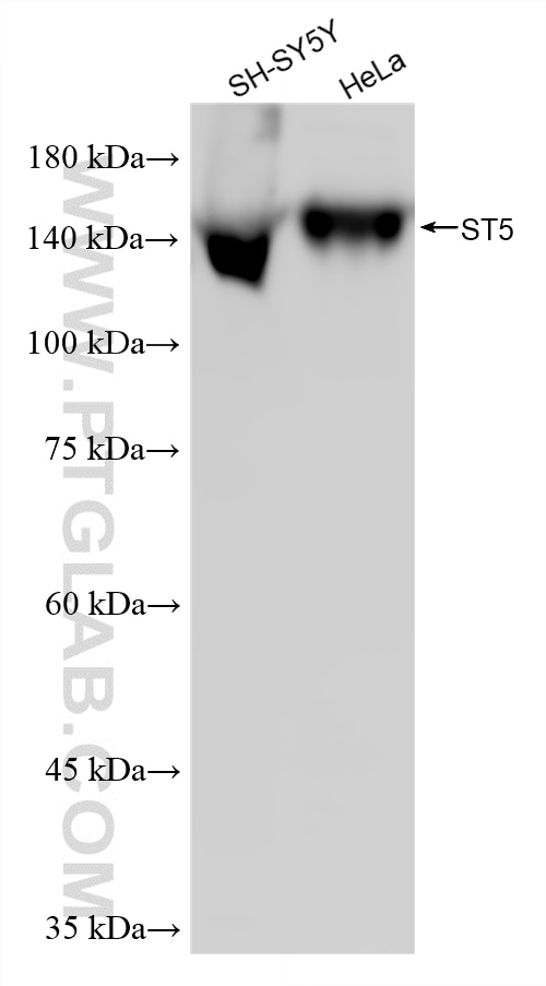 Various lysates were subjected to SDS PAGE followed by western blot with 87628-1-RR (ST5 antibody) at dilution of 1:1000 incubated at room temperature for 1.5 hours. This data was developed using the same antibody clone with 87628-1-PBS in a different storage buffer formulation. Western Blot (WB) analysis of various lysates using ST5 Recombinant monoclonal antibody (87628-1-RR)
