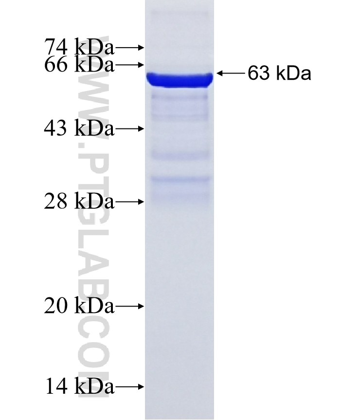 ST5 fusion protein Ag34032 SDS-PAGE