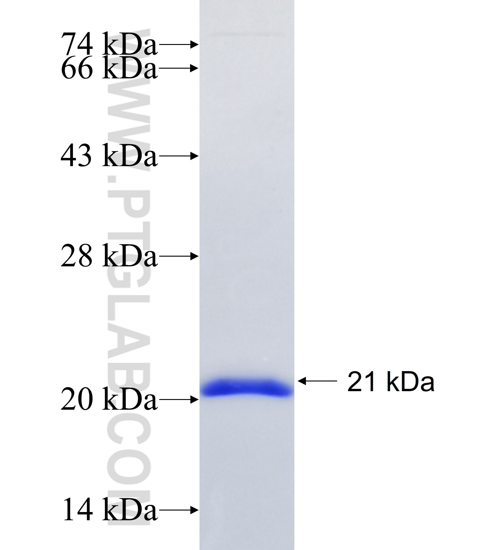 ST5 fusion protein Ag34328 SDS-PAGE ST5 fusion protein Ag34328 SDS-PAGE