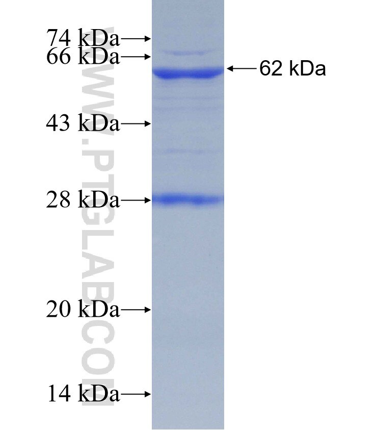 ST5 fusion protein Ag3403 SDS-PAGE