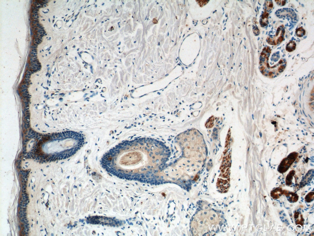 Immunohistochemistry (IHC) staining of human skin tissue using ST6GAL1 Polyclonal antibody (14355-1-AP)