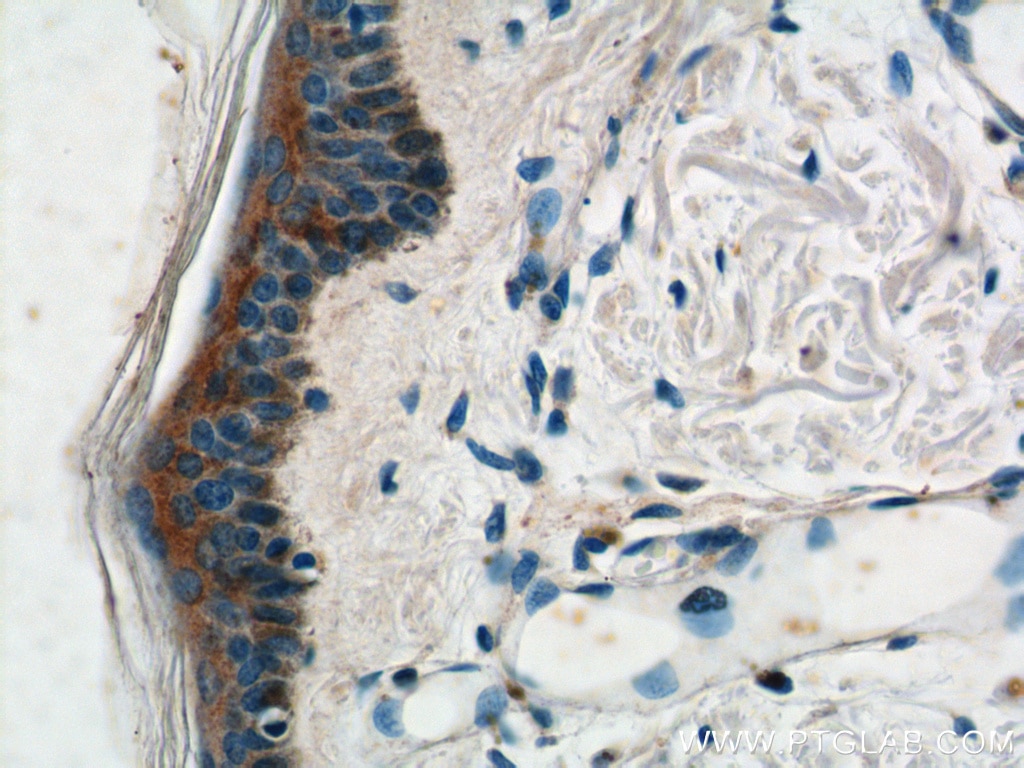 Immunohistochemistry (IHC) staining of human skin tissue using ST6GAL1 Polyclonal antibody (14355-1-AP)