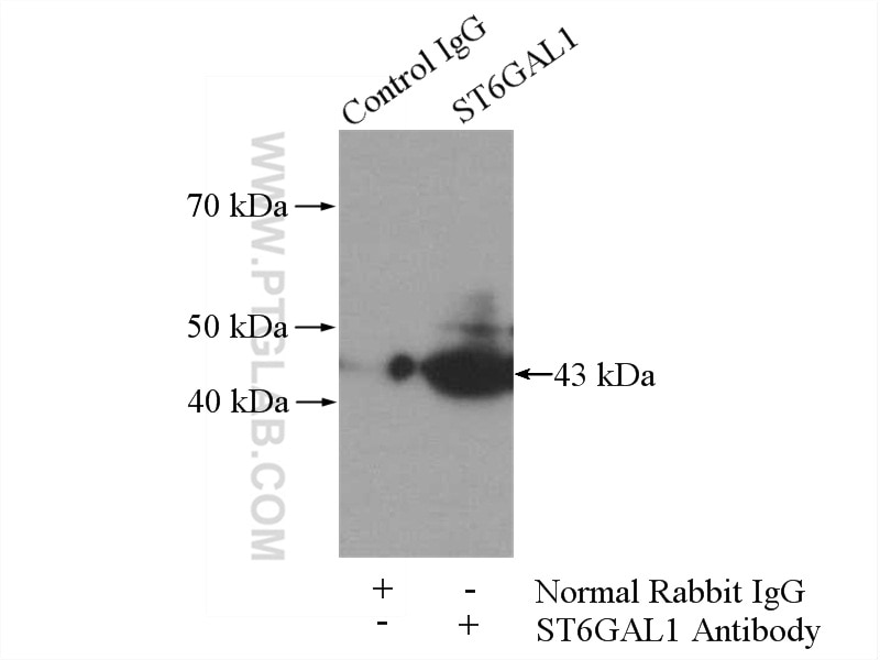Immunoprecipitation (IP) experiment of Raji cells using ST6GAL1 Polyclonal antibody (14355-1-AP)