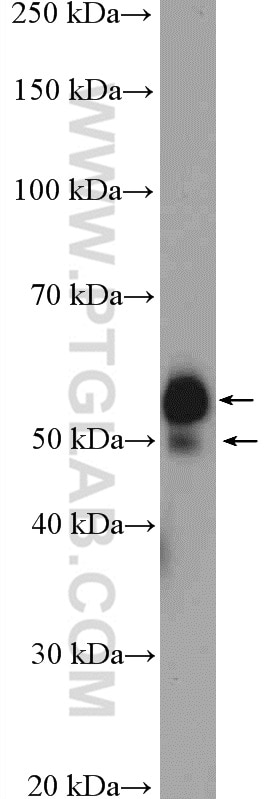 Western Blot (WB) analysis of HepG2 cells using ST6GAL1 Polyclonal antibody (14355-1-AP)