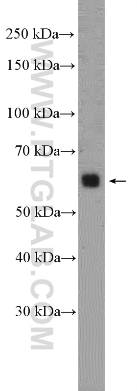 Western Blot (WB) analysis of HuH-7 cells using ST6GAL1 Polyclonal antibody (14355-1-AP)