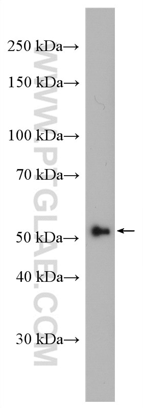 Western Blot (WB) analysis of Jurkat cells using ST6GAL1 Polyclonal antibody (14355-1-AP)