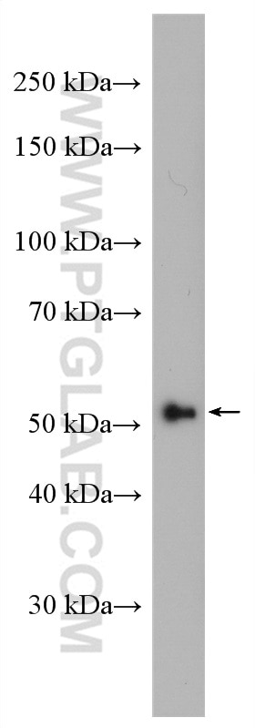 WB analysis of Jurkat using 14355-1-AP