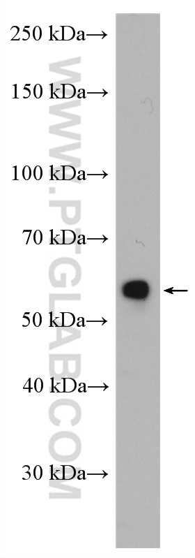 Western Blot (WB) analysis of mouse liver tissue using ST6GAL1 Polyclonal antibody (14355-1-AP)