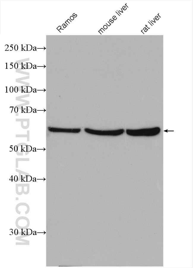 Western Blot (WB) analysis of various lysates using ST6GAL1 Polyclonal antibody (14355-1-AP)