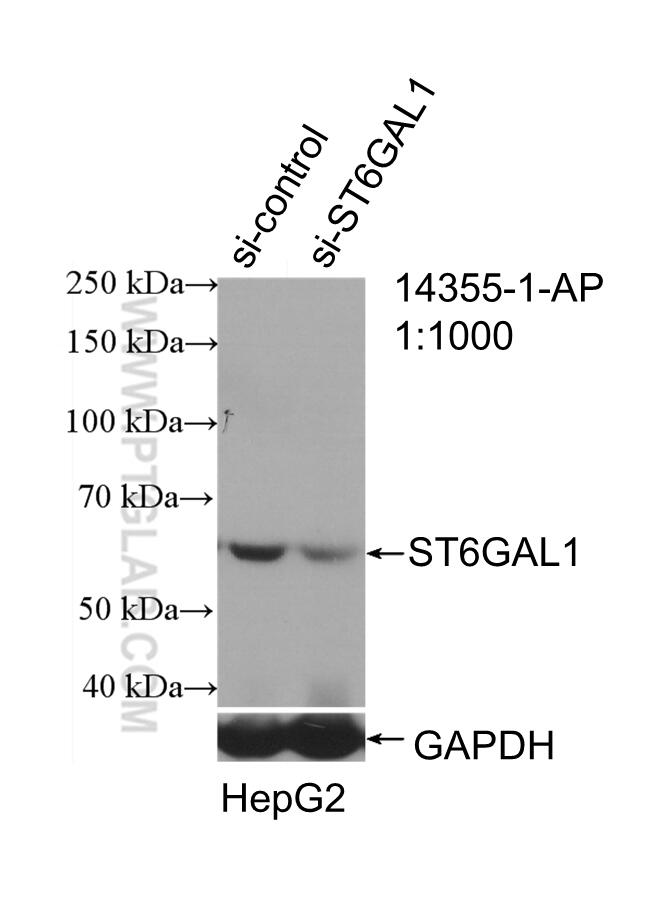 Western Blot (WB) analysis of HepG2 cells using ST6GAL1 Polyclonal antibody (14355-1-AP)