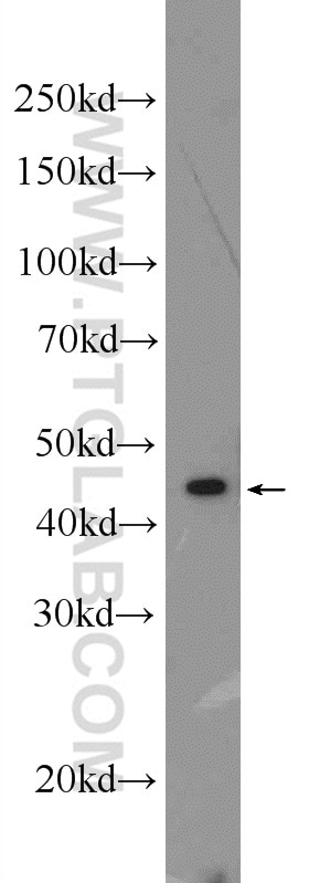 Western Blot (WB) analysis of mouse spleen tissue using ST6GAL1 Polyclonal antibody (14355-1-AP)