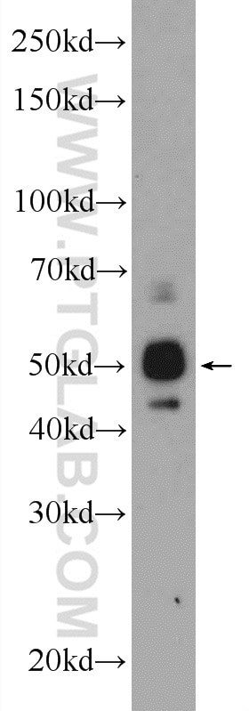 Western Blot (WB) analysis of Raji cells using ST6GAL1 Polyclonal antibody (14355-1-AP)