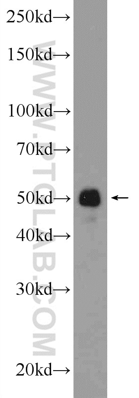 Western Blot (WB) analysis of U-937 cells using ST6GAL1 Polyclonal antibody (14355-1-AP)