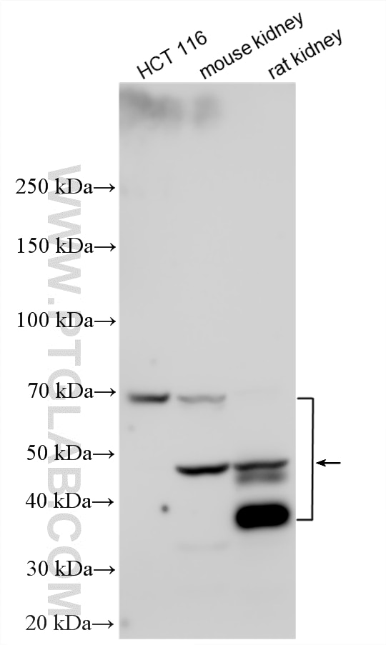 Various lysates were subjected to SDS PAGE followed by western blot with 34030-1-AP (ST6GAL1 antibody) at dilution of 1:1000 incubated at room temperature for 1.5 hours. Western Blot (WB) analysis of various lysates using ST6GAL1 Polyclonal antibody (34030-1-AP)