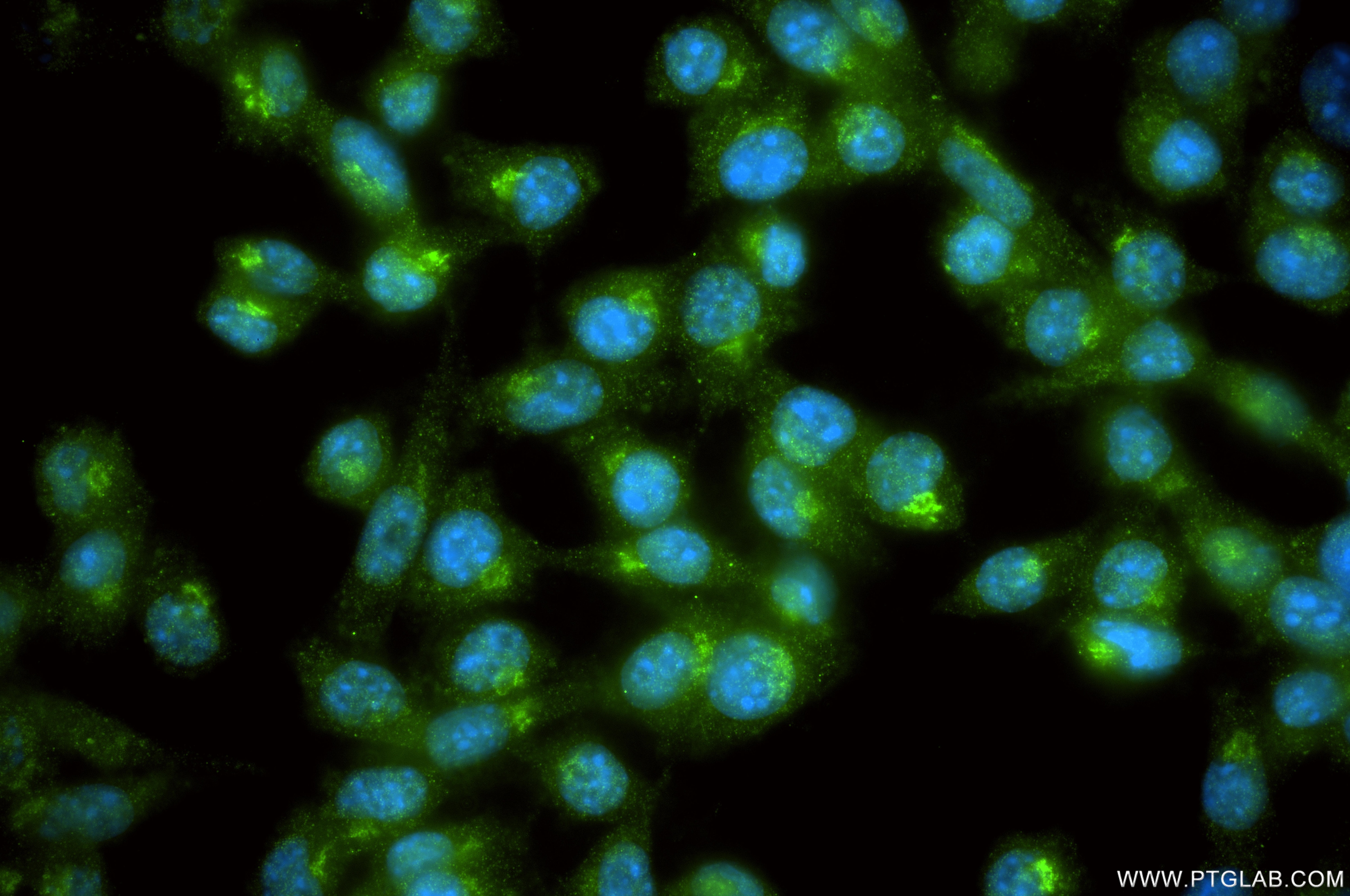 IF Staining of 4T1 using 87468-1-RR Immunofluorescence (IF) / fluorescent staining of 4T1 cells using ST6GAL1 Recombinant monoclonal antibody (87468-1-RR)
