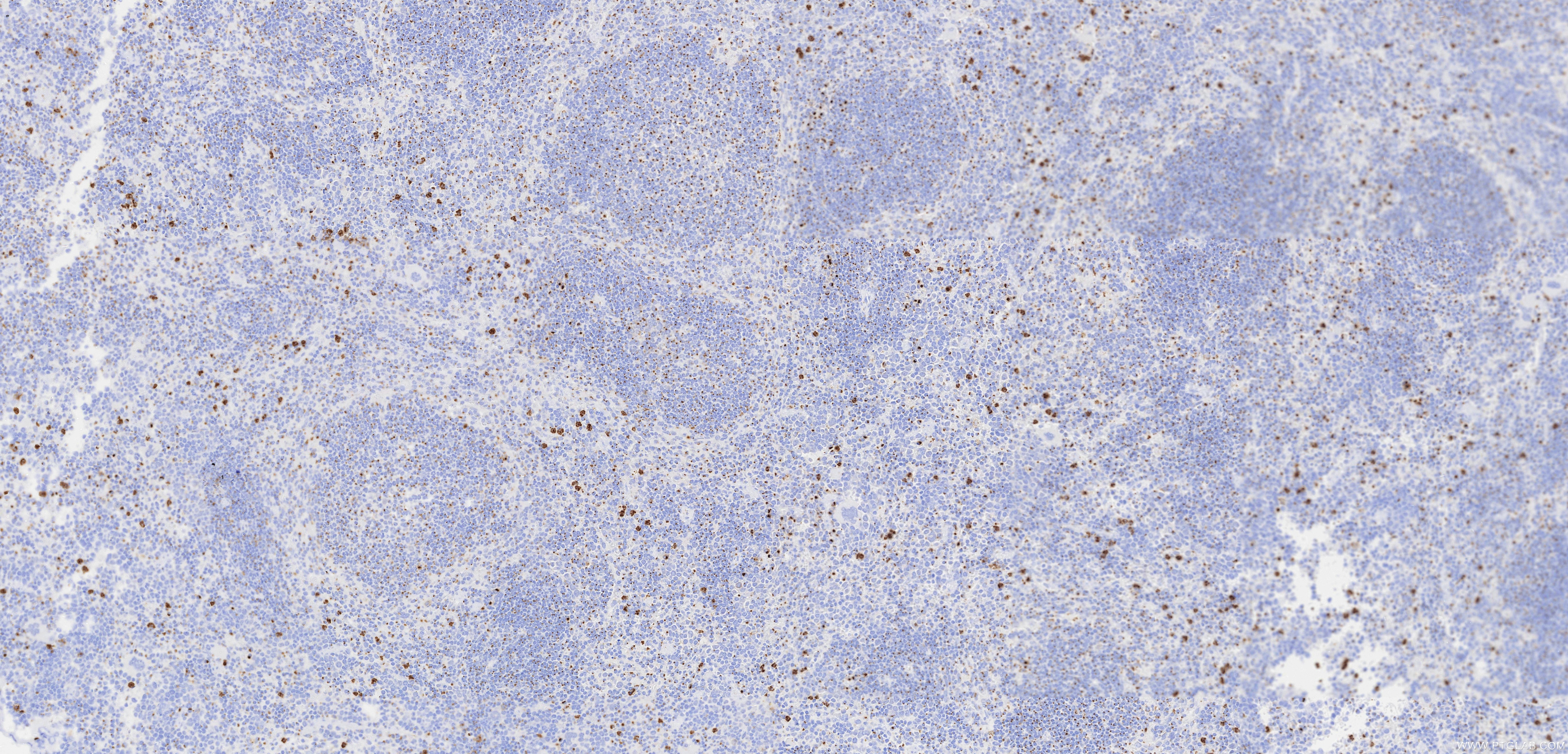 IHC staining of mouse spleen using 87468-1-RR Immunohistochemistry (IHC) staining of mouse spleen tissue using ST6GAL1 Recombinant monoclonal antibody (87468-1-RR)