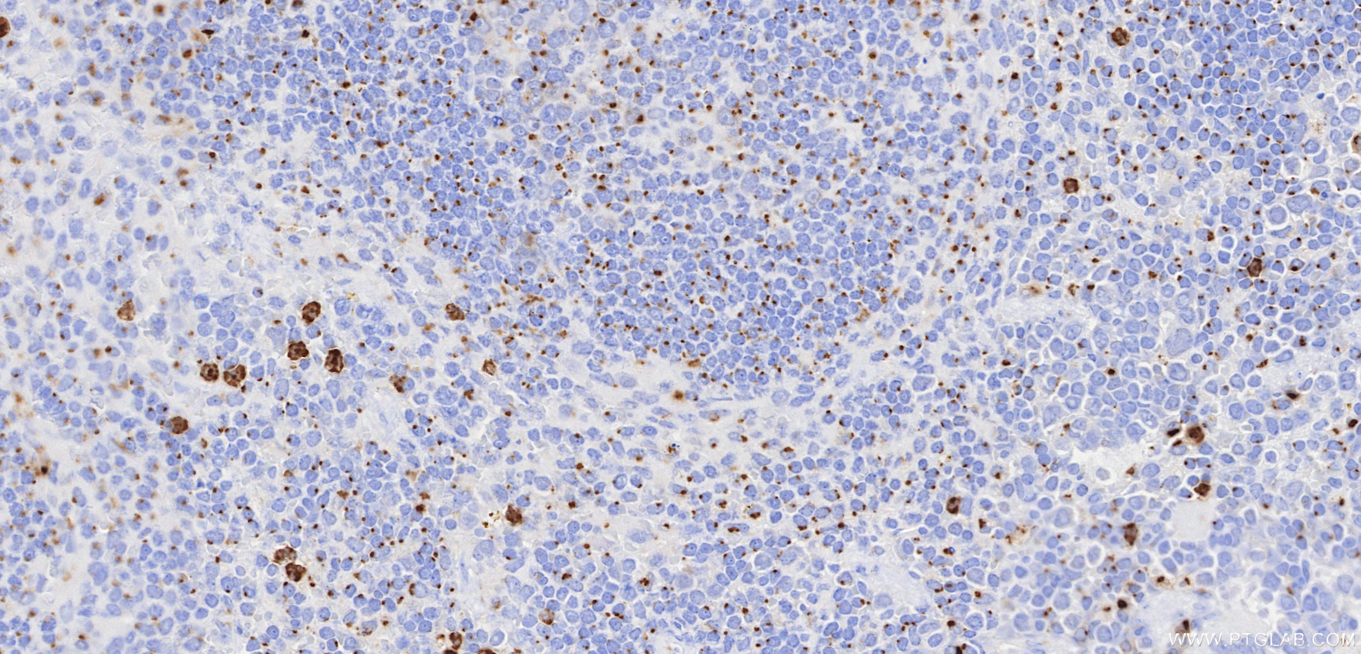 IHC staining of mouse spleen using 87468-1-RR Immunohistochemistry (IHC) staining of mouse spleen tissue using ST6GAL1 Recombinant monoclonal antibody (87468-1-RR)