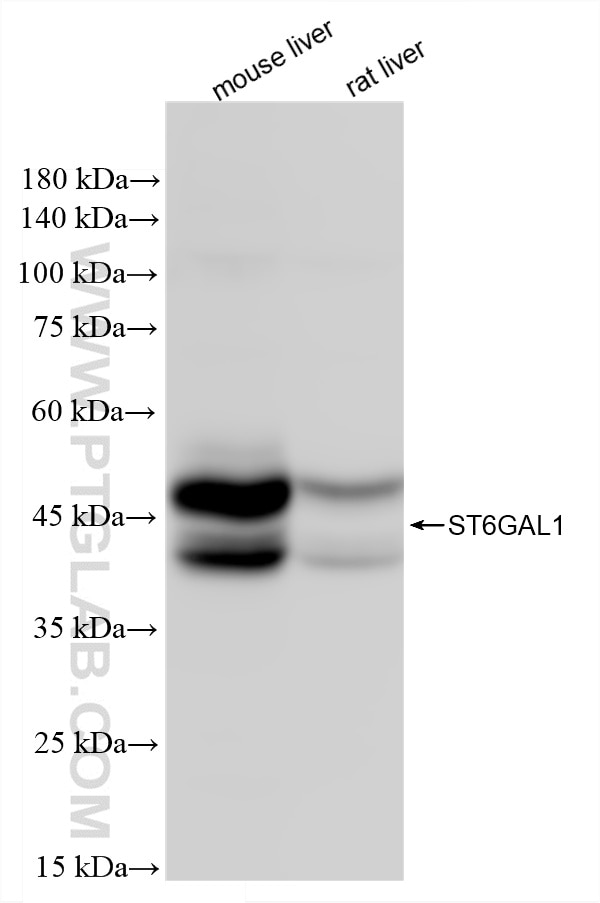 WB analysis using 87468-1-RR Western Blot (WB) analysis of various lysates using ST6GAL1 Recombinant monoclonal antibody (87468-1-RR)