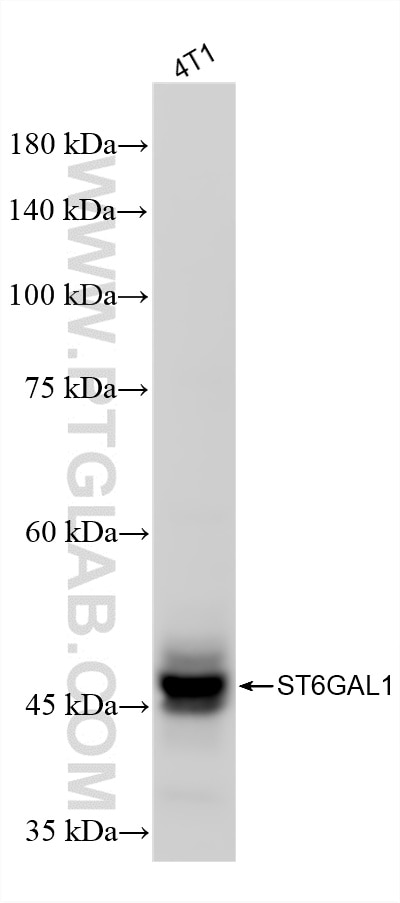 WB analysis of 4T1 using 87468-1-RR Western Blot (WB) analysis of 4T1 cells using ST6GAL1 Recombinant monoclonal antibody (87468-1-RR)