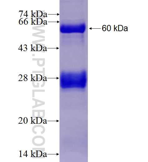 ST6GAL1 fusion protein Ag5705 SDS-PAGE