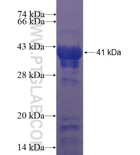 ST6GAL1 fusion protein Ag6181 SDS-PAGE