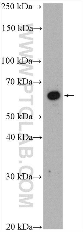 Western Blot (WB) analysis of RAW 264.7 cells using ST6GAL2 Polyclonal antibody (28367-1-AP)