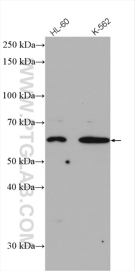 Western Blot (WB) analysis of various lysates using ST6GAL2 Polyclonal antibody (28367-1-AP)