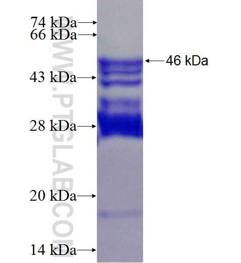 ST6GAL2 fusion protein Ag26357 SDS-PAGE