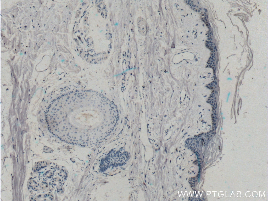 Immunohistochemistry (IHC) staining of human skin tissue using ST6GALNAC1 Polyclonal antibody (15363-1-AP)