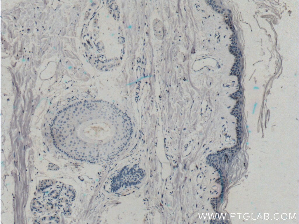 Immunohistochemistry (IHC) staining of human skin tissue using ST6GALNAC1 Polyclonal antibody (15363-1-AP)