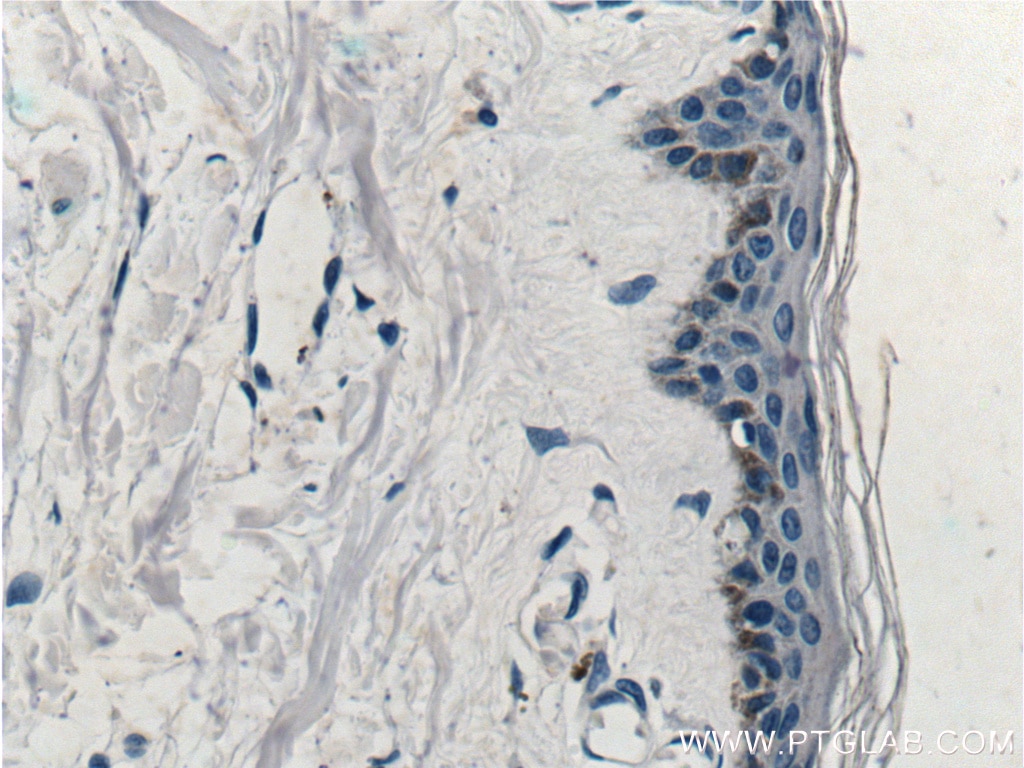 Immunohistochemistry (IHC) staining of human skin tissue using ST6GALNAC1 Polyclonal antibody (15363-1-AP)