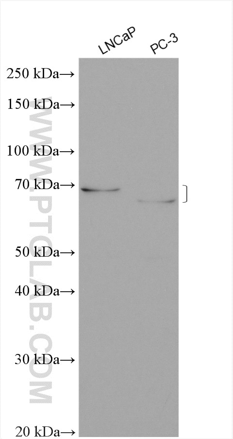 Western Blot (WB) analysis of various lysates using ST6GALNAC1 Polyclonal antibody (15363-1-AP)