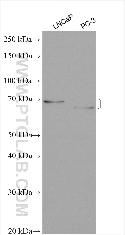 WB analysis using 15363-1-AP