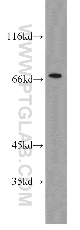 Western Blot (WB) analysis of human stomach tissue using ST6GALNAC1 Polyclonal antibody (15363-1-AP)