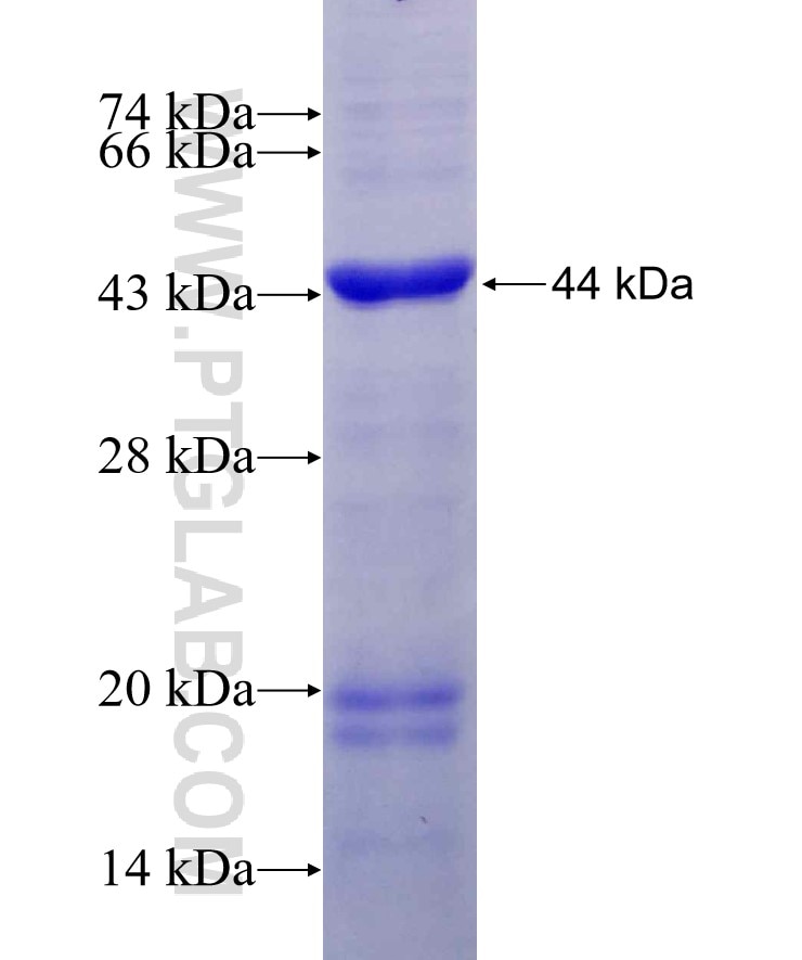ST6GALNAC1 fusion protein Ag8062 SDS-PAGE