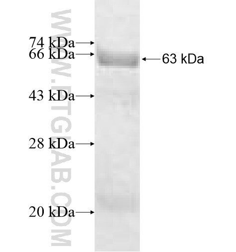 ST6GALNAC2 fusion protein Ag10112 SDS-PAGE